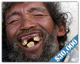 smiling man with bad teeth
