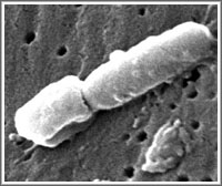Klebsiella bacteria image