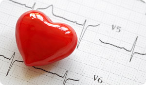 Heart Attack Vs. Cardiac Arrest: Understanding the Terms