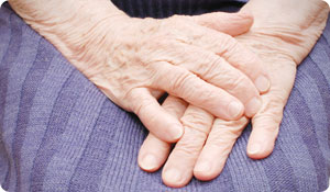 Rheumatoid Nodules: Frequently Asked Questions