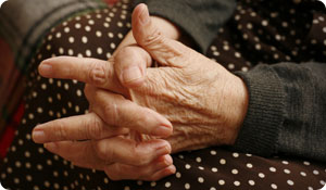 Understanding Arthritis-Related Numbness