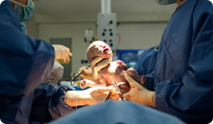 New C-Section Guidelines: How Will They Affect You?